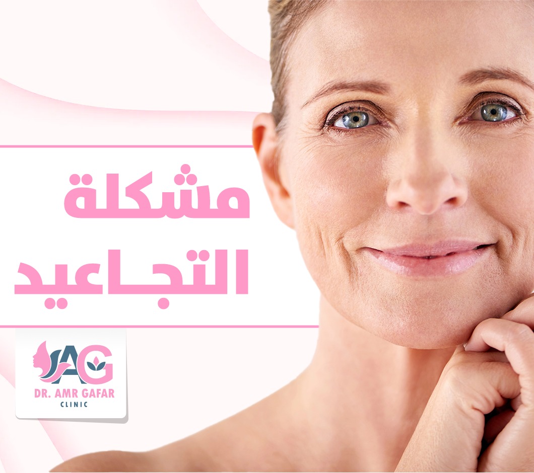 مشكلة التجاعيد وكيفيه التعامل معها 